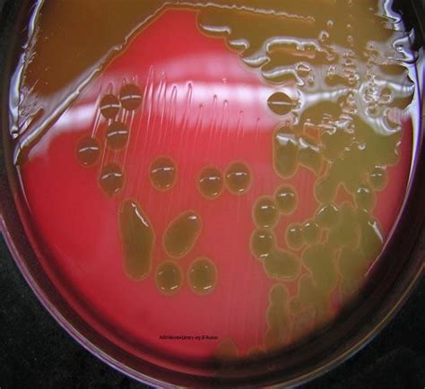 strep pneumoniae test on blood agar put drops of|streptococcus pneumoniae hemolysis type.